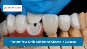 Restore Your Smile with Dental Crowns in Gurgaon