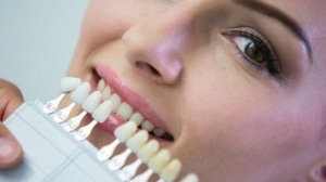 Step-by-Step Guide to Getting E-max Veneers