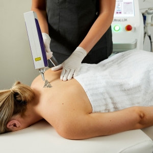 Clear Skin, Clear Mind – Laser Tattoo Removal Works!