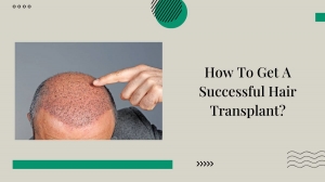 How To Get A Successful Hair Transplant?