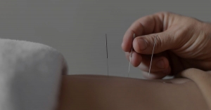 Discover the Power of Acupuncture Treatment for Woodbury MN: A Natural Path to Wellness
