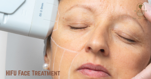 HIFU Face Treatment