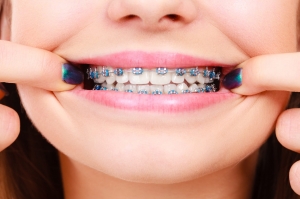 Orthodontic Anatomy: A Dubai Perspective