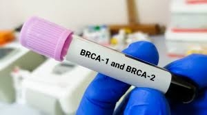 BRCA Testing: A Vital Step Toward Informed Cancer Risk Management