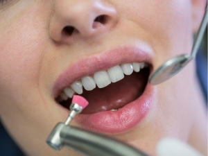 Are There Risks Associated with Teeth Scaling and Polishing?