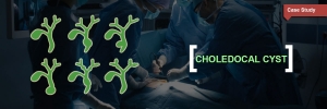 Choledochal Cyst in Children: Early Diagnosis and Minimally Invasive Treatment in Delhi