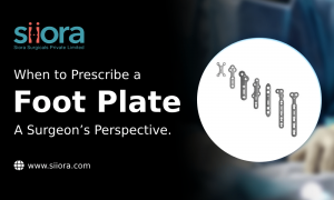 When to Prescribe a Foot Plate – A Surgeon’s Perspective.