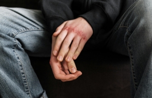Injury Recovery: How to Safely Manage Your Rehabilitation Process