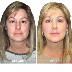 How To Choose The Best Plastic Surgeons In Houston?