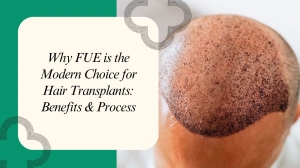 Why FUE is the Modern Choice for Hair Transplants: Benefits & Process