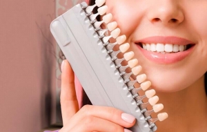 Who Is a Good Candidate for Composite Veneers?