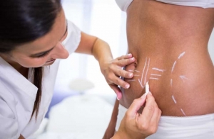 Sculpt Your Legs: Thigh Liposuction in Islamabad Clinics
