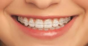 So Many Benefits to having a Straight Smile: Find out about Newtown Invisalign