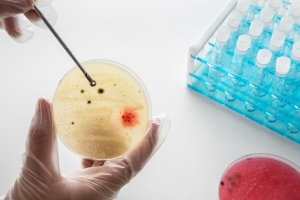 Transforming Cancer Care: Revolutionary Advances in Mantle Cell Lymphoma Treatment Markets