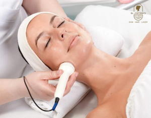 Fractional Laser Resurfacing