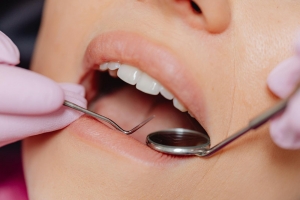 Tooth Filling Aftercare: Tips for a Smooth Recovery