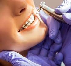If you live in Smyrna, DE you may have been doing a search for best orthodontist near me?