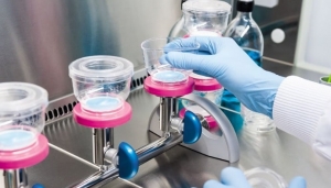 Bioburden Testing Market Size, and Growth Forecast 2025-2032