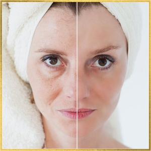 Are You Ready for a Facelift? Everything You Need to Know About This Popular Cosmetic Procedure