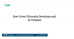 How Liver Fibrosis Develops and Is Treated