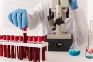 Why Is It Essential To Choose A Reliable Supplier For EDTA Blood Collection Tubes?