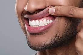 What techniques are used in gum depigmentation?