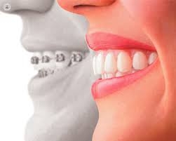 Assabet Orthodontics Sudbury and Maynard MA – Hitting the trails in your truck is a joy – the same way it becomes a bore so easily!