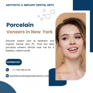 Top Porcelain Veneer Dentist in Brooklyn: Your Guide to Perfect Smile
