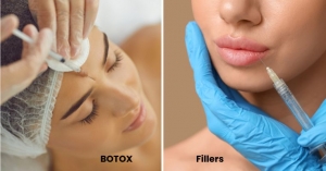 Botox vs. Fillers: What’s the Difference?