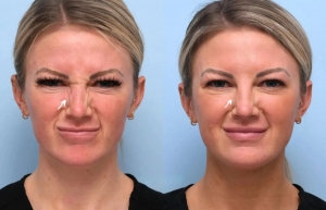The Best Aesthetic Clinic in Dubai Offering Botox: Safe, Effective, and Quick Results