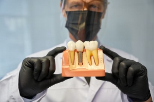 Get Dental Implants in Encino Today