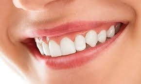How Much Does Digital Smile Design Cost?