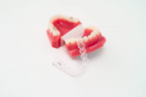 Nighttime Dental Retainers: Benefits and Usage Tips
