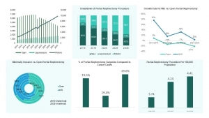 Surgical Procedure Volume Database: Strategic Healthcare Intelligence by BIS Research