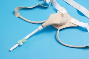 Stress Urinary Incontinence Devices Market: Size, Trends, and Growth Forecast 2025-2032