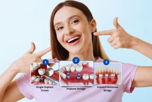 Digital Smile Design in Houston: How 3D Planning is Revolutionizing Cosmetic Dentistry