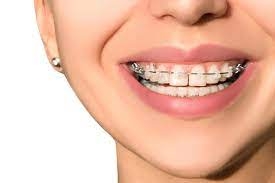 ​​​​​​​Favorite Orthodontist From St. Augustine