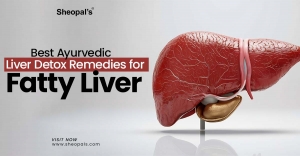 Best Ayurvedic Liver Detox Remedies for Fatty Liver
