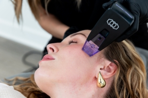 Morpheus8 Treatment Is the Star of Every Skincare Trend