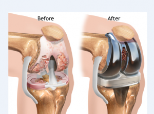 Best Arthroscopic Knee Surgeon in Delhi: Expert Care for Faster Recovery