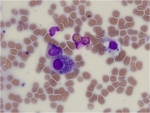 Histoplasmosis Treatment Market Size, Trends, and Growth Forecast to 2032