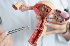 Traitement du Cancer de la Vulve en Inde avec EdhaCare : Soins de Pointe à Coût Abordable