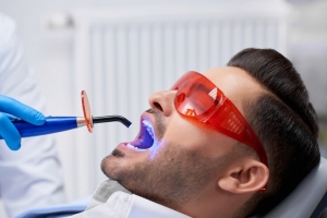 Teeth Whitening Options Available for Wilmslow Residents