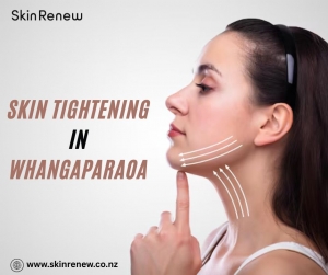 Ready to Refresh Your Skin? Skin Tightening in Whangaparaoa by Skin Renew