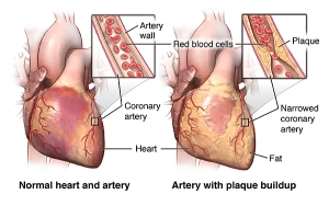 Interventional Cardiologist in Kalyani - Mahajan Heart Clinic
