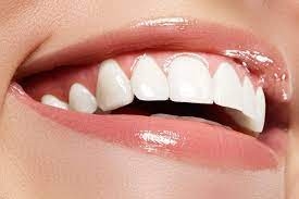 Zoom Whitening vs. Over-the-Counter Options