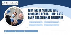 Why More Seniors Are Choosing Dental Implants Over Traditional Dentures