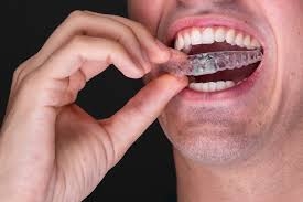What’s the Difference Between a Night Guard and a Mouth Guard?