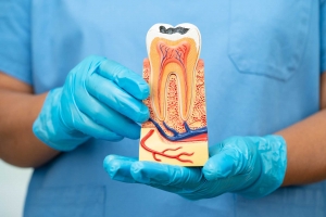 Understanding Root Canal Treatment: When and Why It's Needed