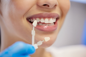 Transform Your Smile with Veneers: What to Expect from a Garland, TX Cosmetic Dentist